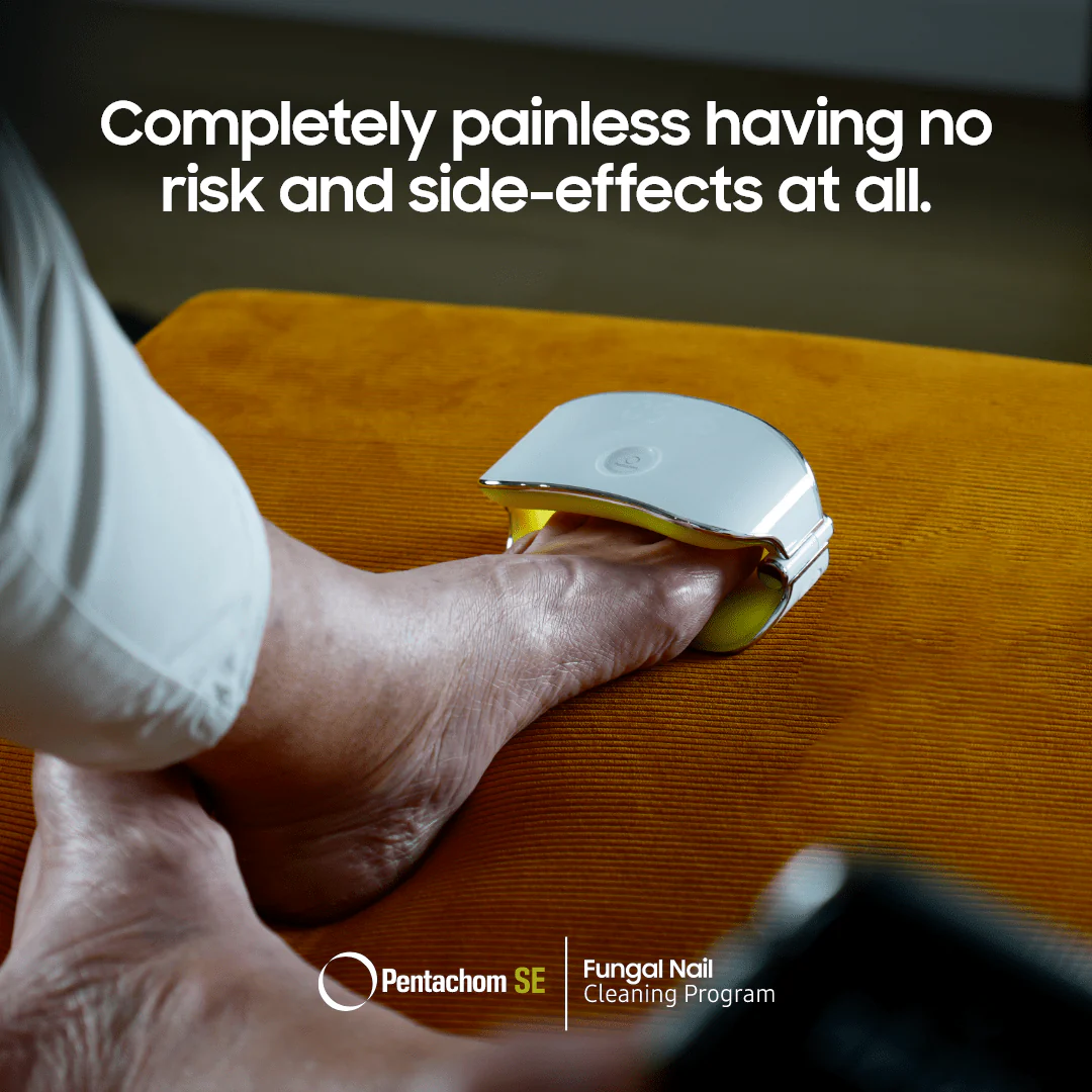 The Inside-Out Complete Solution for Nail Fungus - Image 3