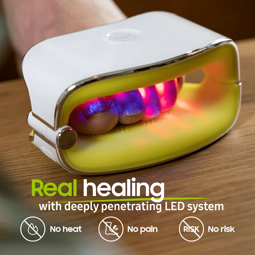 The Inside-Out Complete Solution for Nail Fungus - Image 5