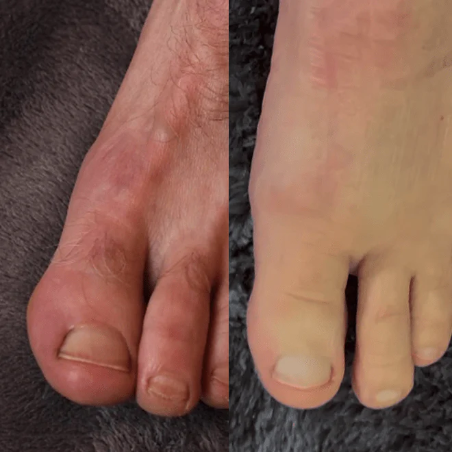 The Inside-Out Complete Solution for Nail Fungus - Image 9