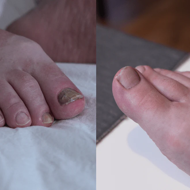 The Inside-Out Complete Solution for Nail Fungus - Image 10