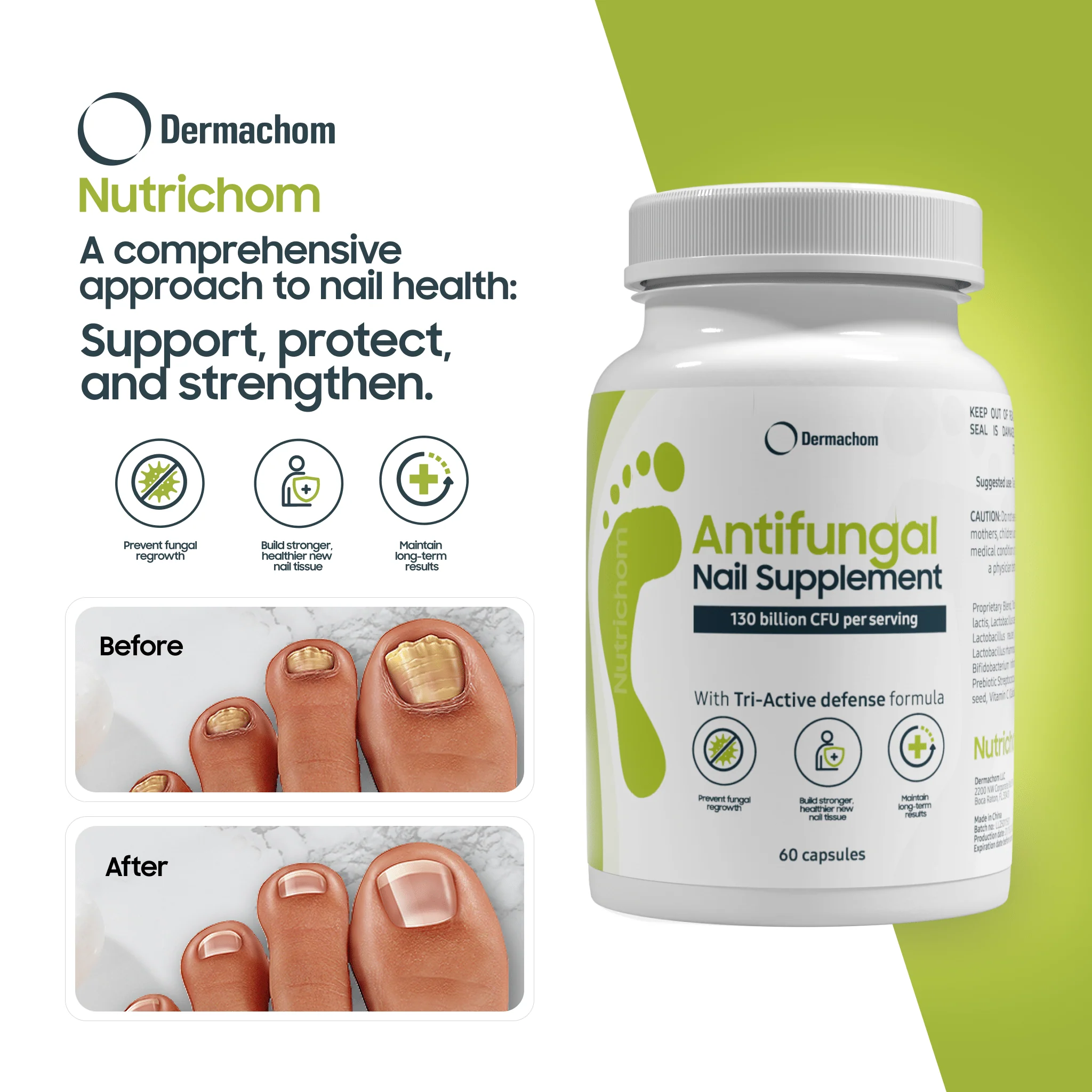 Nutrichom - Antifungal Supplement - Image 4